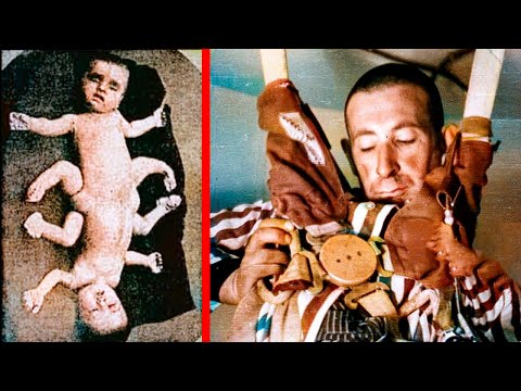 The Most Brutal Experiments of Nazi Concentration Camps Revealed