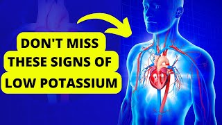 10 Signs of Low Potassium | Symptoms of Potassium Deficiency