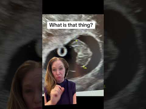 The yolk sac .   ￼#pregnant #ultrasound #ttc #fertility #whatisthat