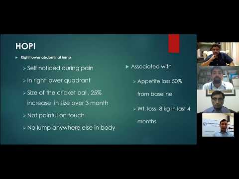 ISG Masterclass II: 4 Approach to Lump Abdomen