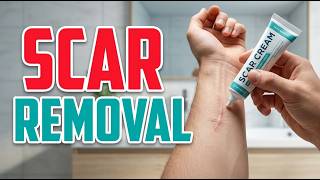 TOP 5 Best Scar Removal Creams 2026
