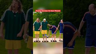 Pouring 190 Proof Everclear On Open Wounds! #shorts #funny #science