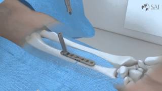 Video de producto