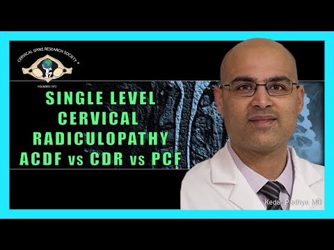 Single Level Cervical Radiculopathy:  ACDF vs CDR vs PCF