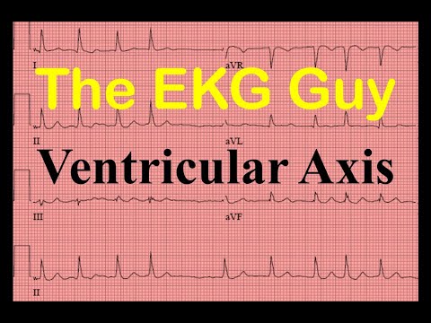 EKG/ECG How to find Ventricular (QRS) Axis - Question 3.0 l The EKG Guy