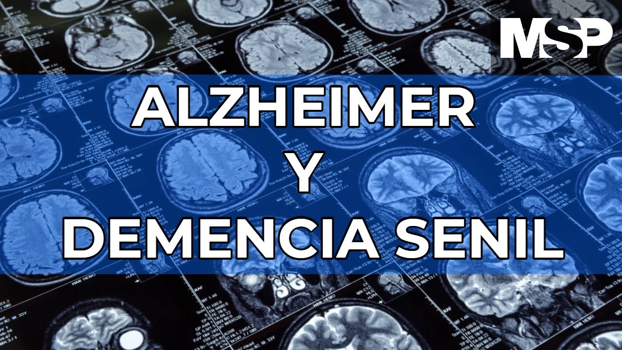 El #Alzheimer y la #Demencia Senil - #ExclusivoMSP