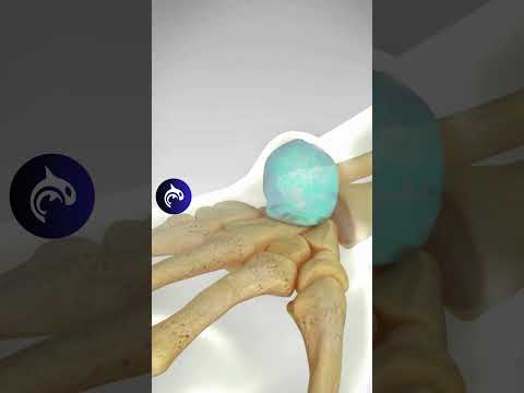 Trigger Finger Condition and Release 3D Animation No Narration