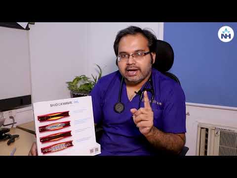 Intravascular Lithotripsy (IVL) | Dr. Auriom Kar