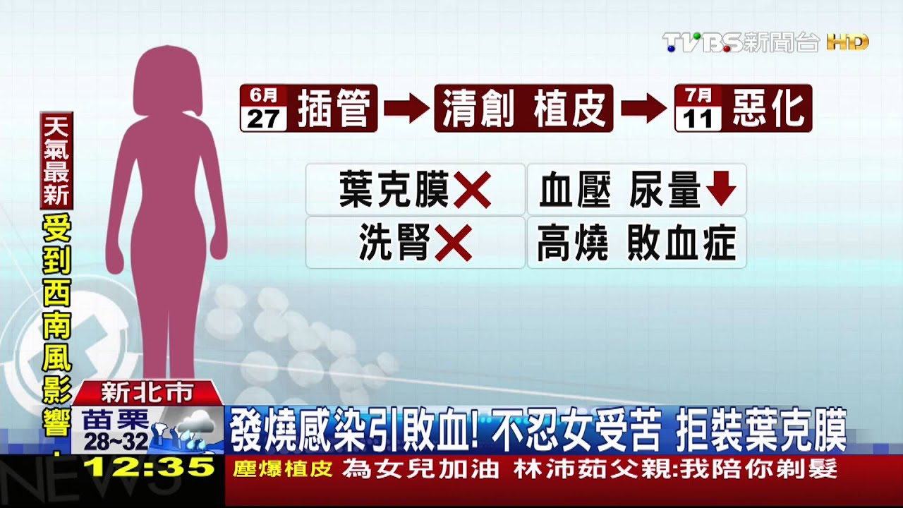 憾！塵爆第5死　22歲黃小軒90%燒傷不治