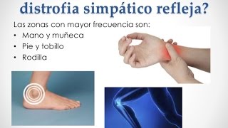 Sindrome de Sudeck - Recomendaciones de Rehabilitacion