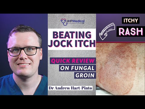 Beating Jock Itch | A Doctors Guide to Tinea Cruris | Fungal Groin Infection