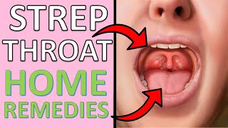 16 POWEFUL Home Remedies For Strep Throat | Causes, Symptoms & Treatment For Strep Throats