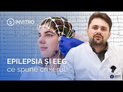 Epilepsy and EEG | What the brain reveals