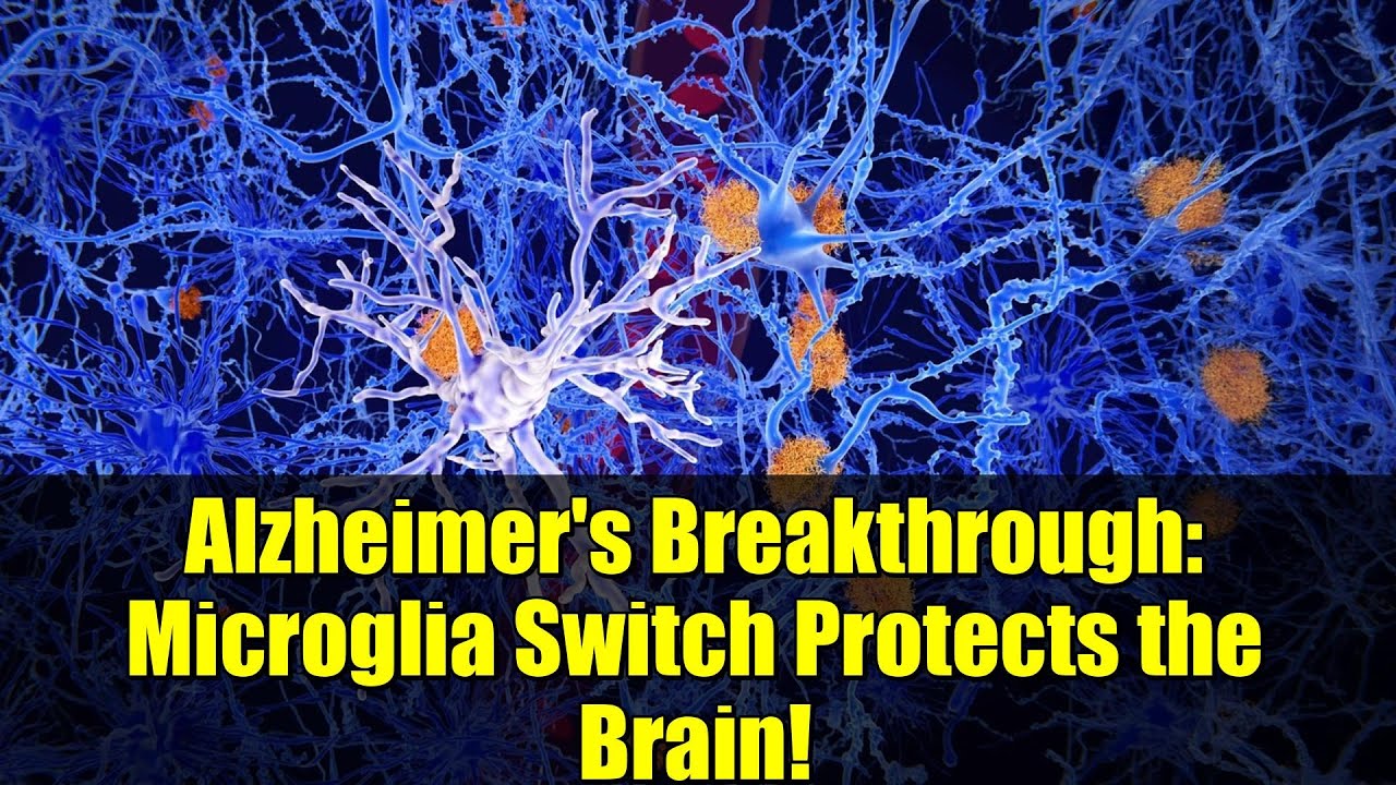 Molecular Switch in Microglia Unlocks Potential New Avenue for Alzheimer's Therapy