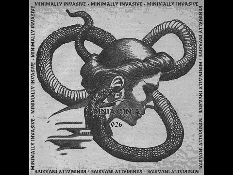 Minimally Invasive 026 Rinia Rinia ( #rominimal , #minimal , #deeptech #musicseries )