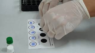 Aglutinação do Látex - Prof. Dr. Adriano Moraes