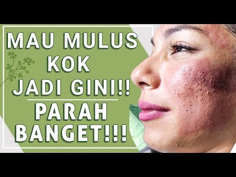 Diet untuk anak-anak berat badan Harga untuk pakaian Slimming