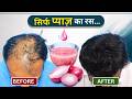 Does Onion Juice Control Hair Fall क्या प्याज बालों के झड़न�
