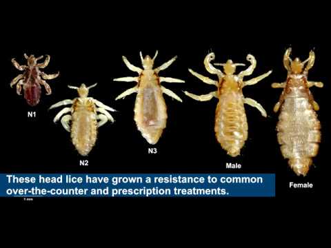 Household product safely cures drug resistant head lice