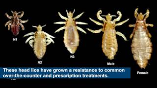 Household product safely cures drug resistant head lice