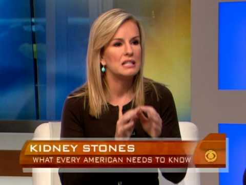 Preventing Kidney Stones