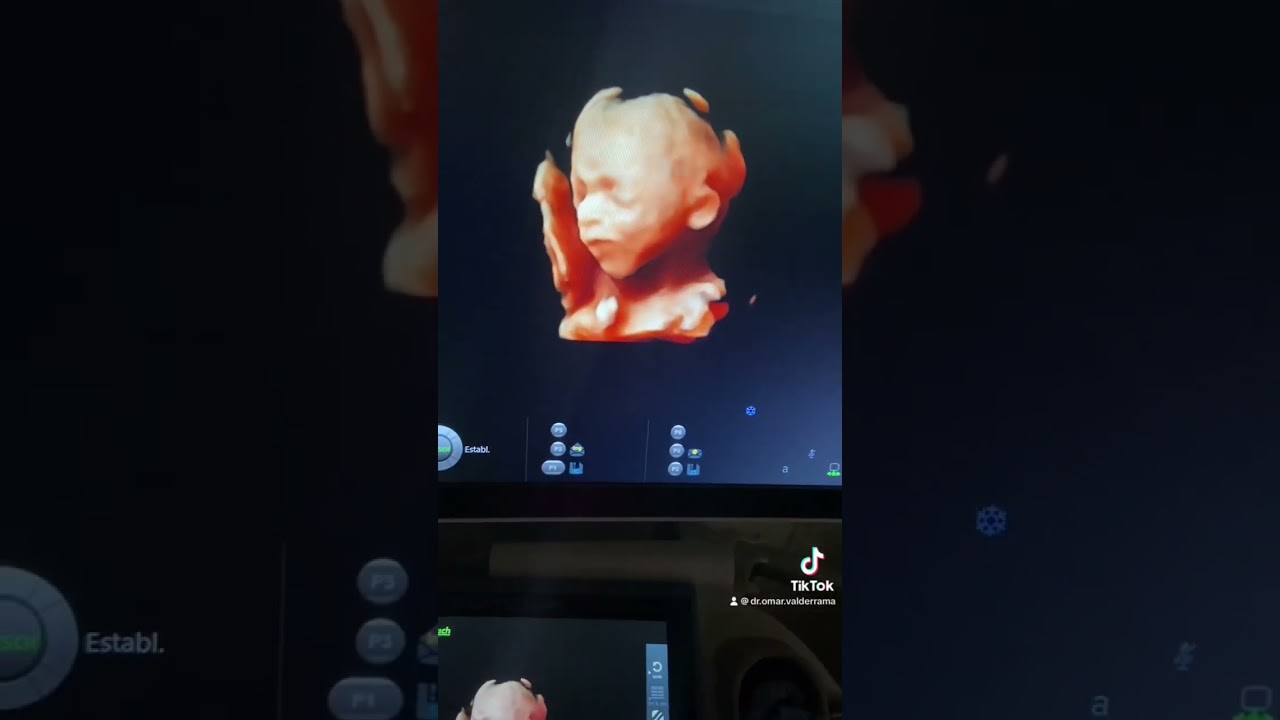 Omar Valderrama Loyola-25