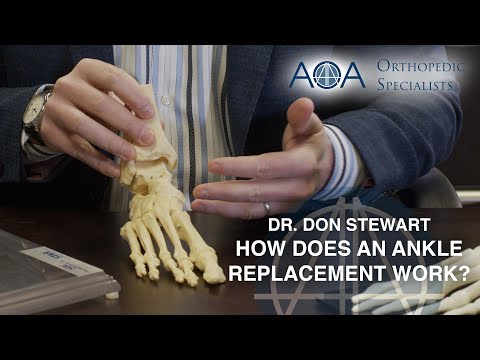 AOA Orthopedic Specialists - How Does a Total Ankle Replacement Work? - Dr. Don Stewart