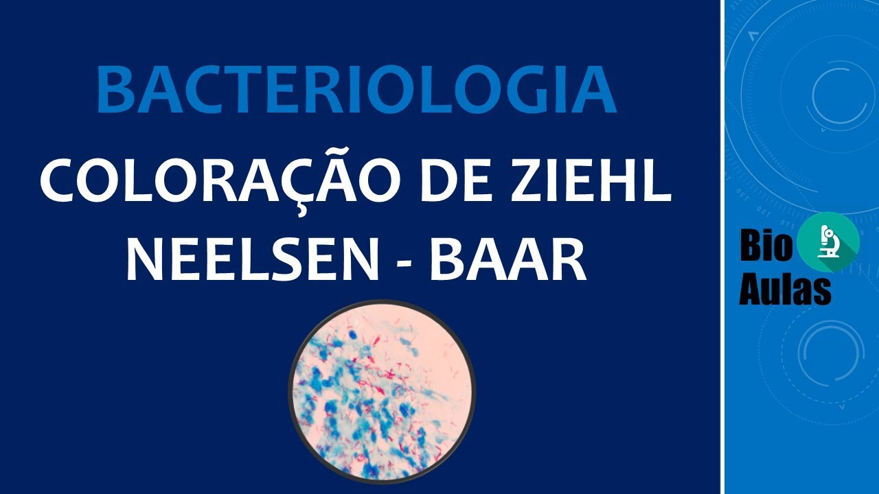 Coloração de Ziehl Neelsen: Baciloscopia (Microbiologia) - Bio Aulas