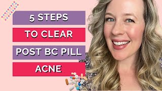 Post birth control acne? 5 steps to clear hormonal acne naturally