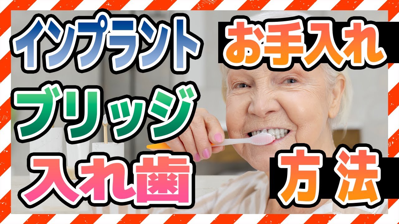 【比較】インプラント、ブリッジ、入れ歯のそれぞれのお手入れ方法を紹介!【長持ちの秘訣】