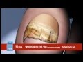 Aragan Secret за красиви нокти