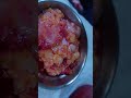 Gynecomastia Surgery Cure Of Gynecomastia Surgery Manboobs Surgery Result Youtubeshorts