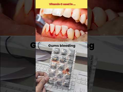 Vitamin C chewable Tablet 500 mg uses ... #pharmacisy #pharmacy #doctor #uses #shorts