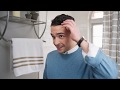 Keeps Hair Loss Commercial - 
