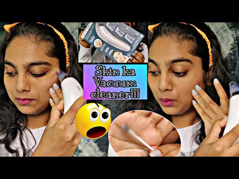 OMG 😱 Face pr Vacuum Cleaner / Derma Suction Live Demo / Lavishka Jain Video