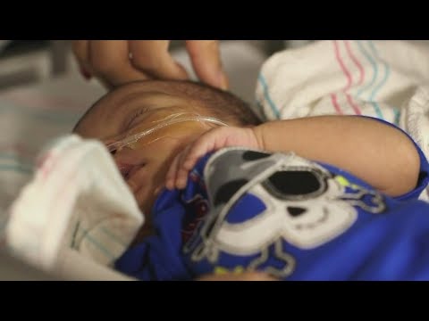 How to prevent the spread of RSV in babies