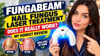 FungaBeam Review 2026: Does It Work for Nail Fungus? My Honest Review Before You Buy!