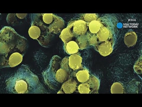 How flesh-eating bacteria works