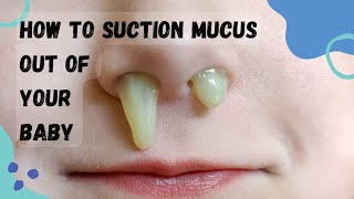 How to Suction Mucus Out | #Suction #Mucus Out of Your Baby | Yesmaam