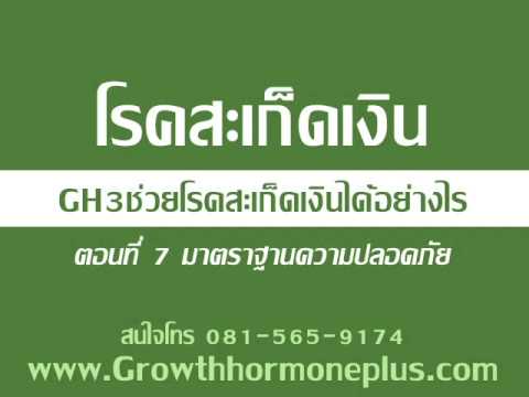 กลากความงาม คุณสมบัติเป็นประโยชน์ของขิงในโรคสะเก็ดเงิน