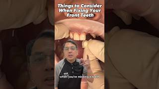 Download lagu Fixed Bridge & Composite Bonding on Anterior Teeth | In Office to Hands On Dental Training #shorts mp3