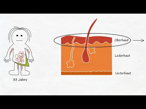 Krankheit ist anders - Neurodermitis nachvollziehen (Erfahrungsbericht 3, Neue Medizin, 5BN, GNM)