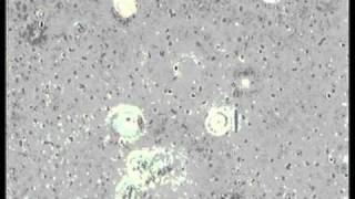 MIND OVER MIDI - Bakterial Soup