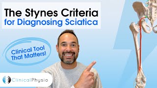 Stynes Criteria Explained | Diagnosing Sciatica for Physiotherapists