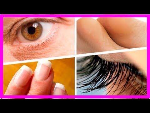 Wie vom Biberstrahl die Schuppenflechte zu behandeln Essliwer den Fort oder essenziale bei der Schuppenflechte
