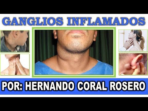 Inflamados video