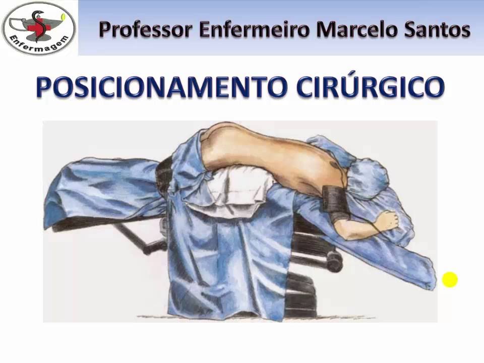 Enfermagem Cirúrgica - Posições Cirúrgicas