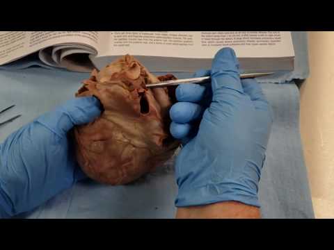 External and Internal Features of the Heart