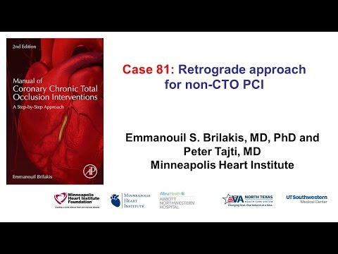 Case 81: Manual of CTO Interventions - Retrograde wiring for non-CTO PCI