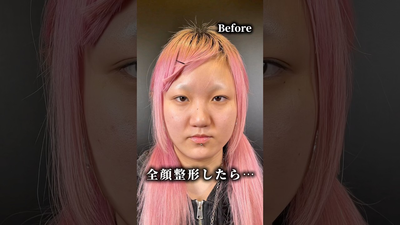 【全顔整形】#shorts どう変わる？